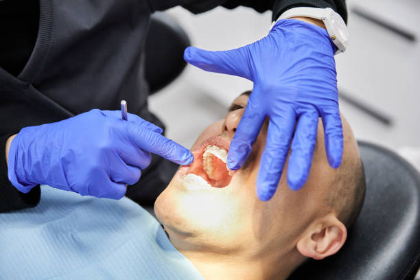 Best Cracked Tooth Emergency Dentist  in Csar Chvez, TX
